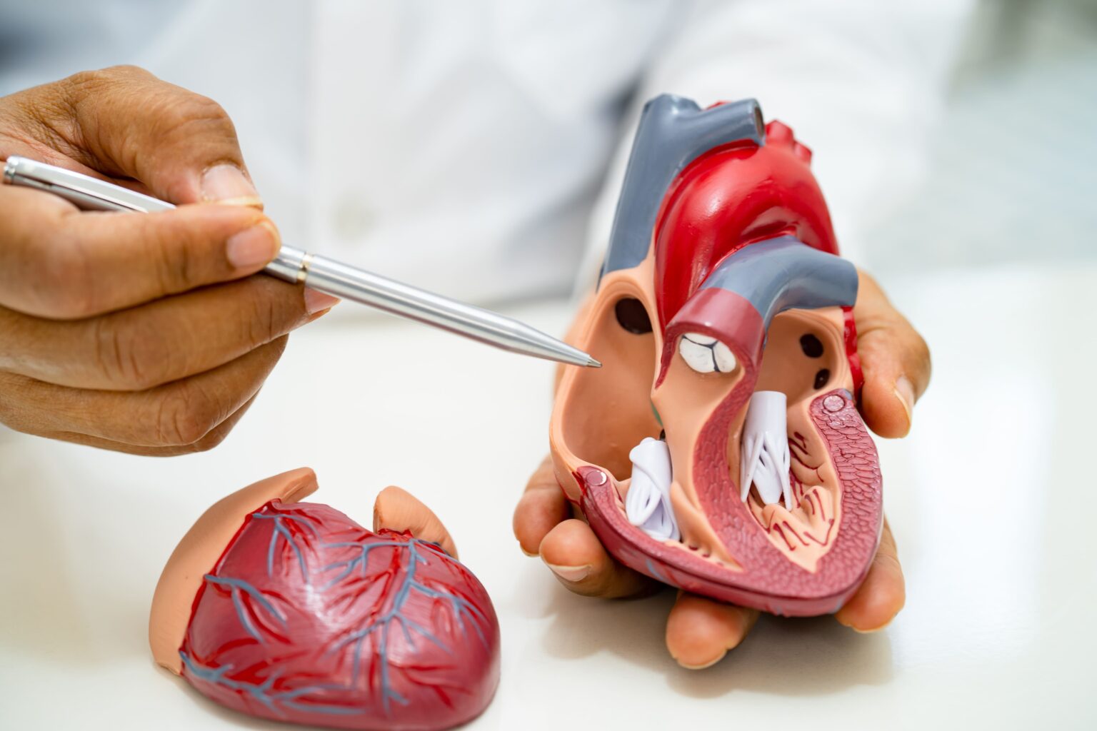 Image Carrington valvular heart disease