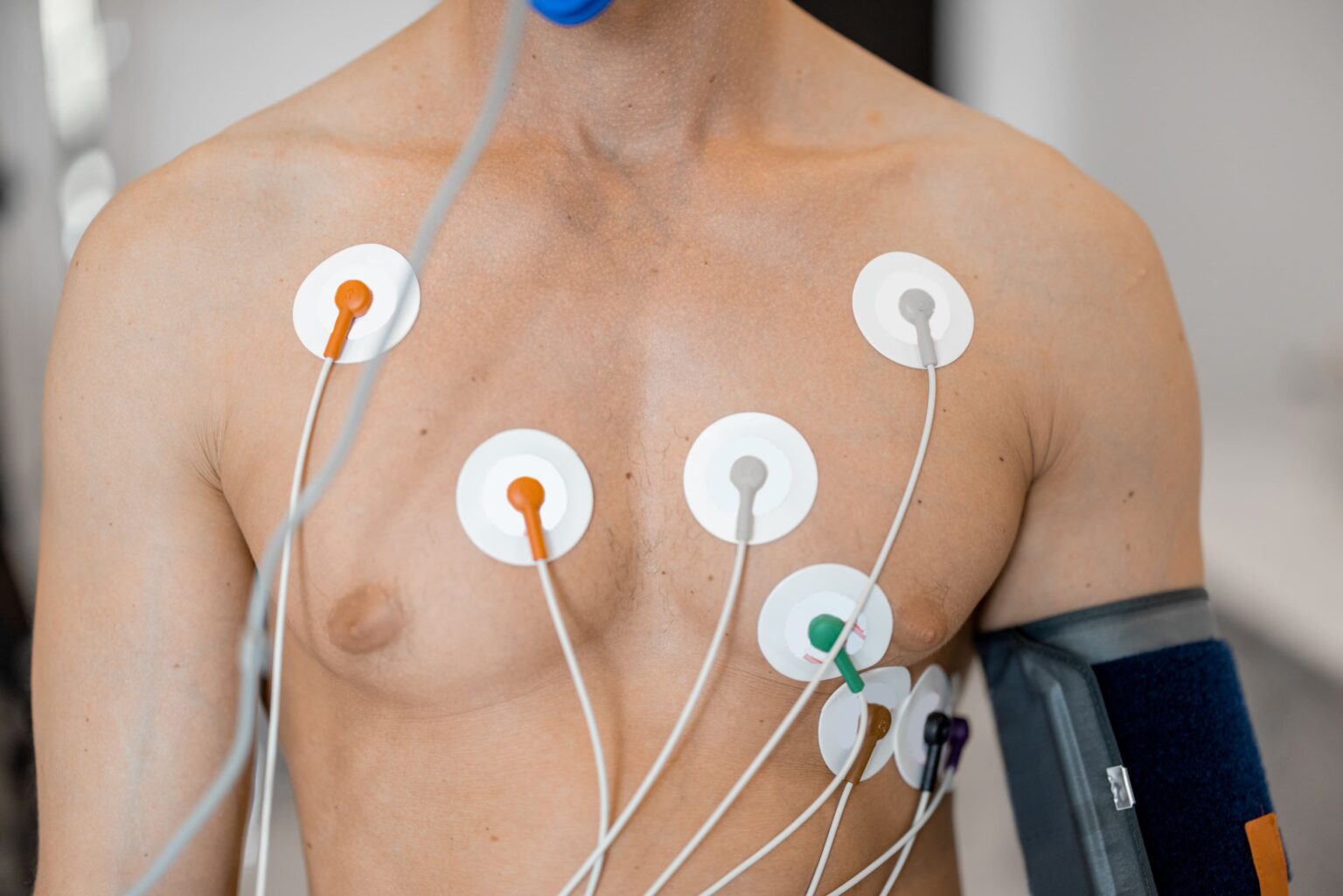 Image Electrocardiogram (ECG)