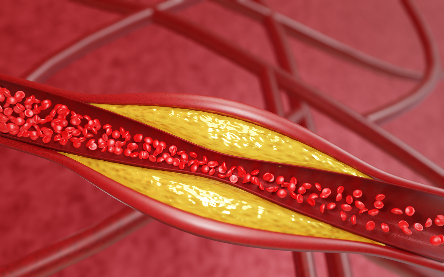Image coronary artery