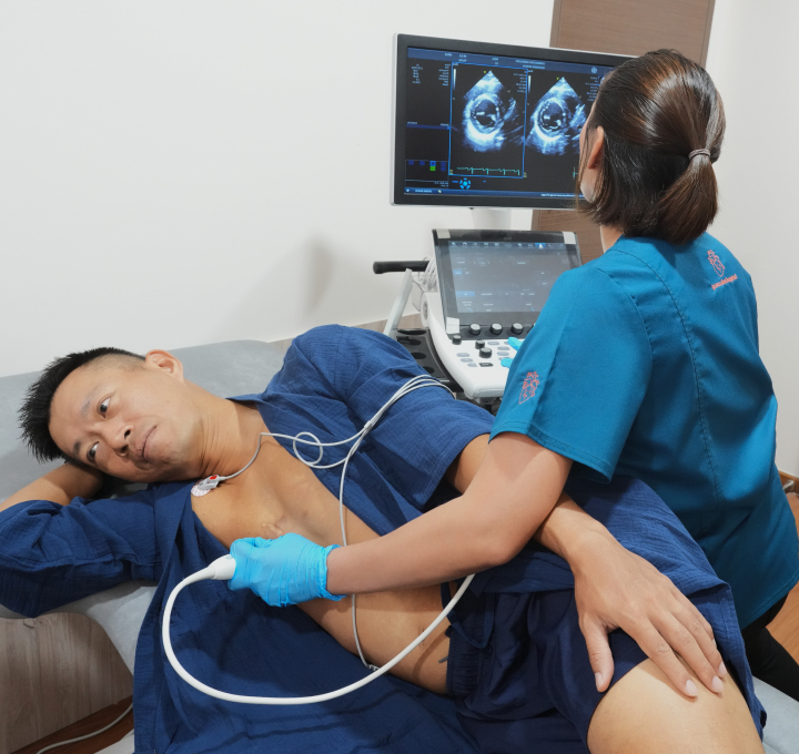Image stress echo